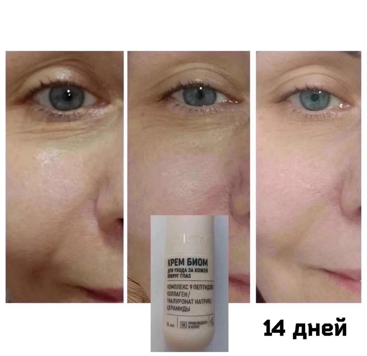 Девчули, разница 14 дней🔥
Крем вокруг глаз, который работает с микробиомом кожи👍