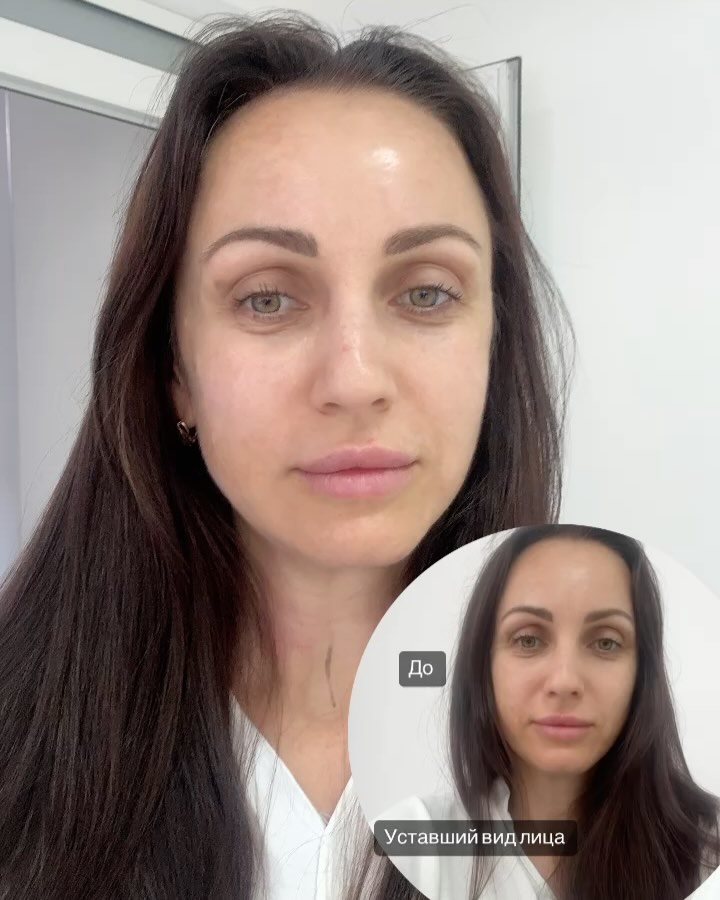 dr.stepanenko.off в LOOKY. . Инновационная полимо...