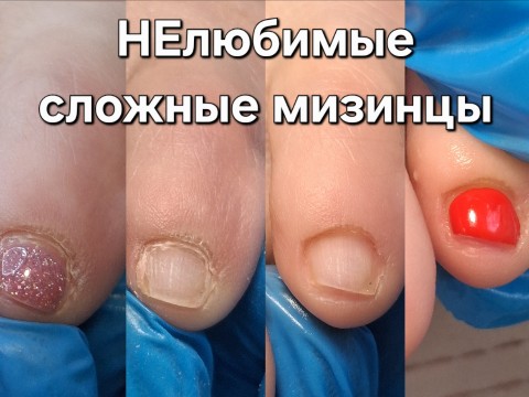 Афонина Екатерина в LOOKY. #педикюр,#красота,#уходзаногтями,#мизинцы,#мастеркрасоты. Сложные мизинцы: выз...