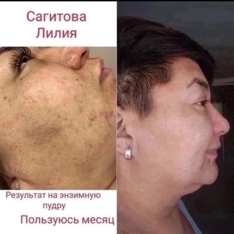 Evgeniya в LOOKY. . Отзывы на нашу энзим...
