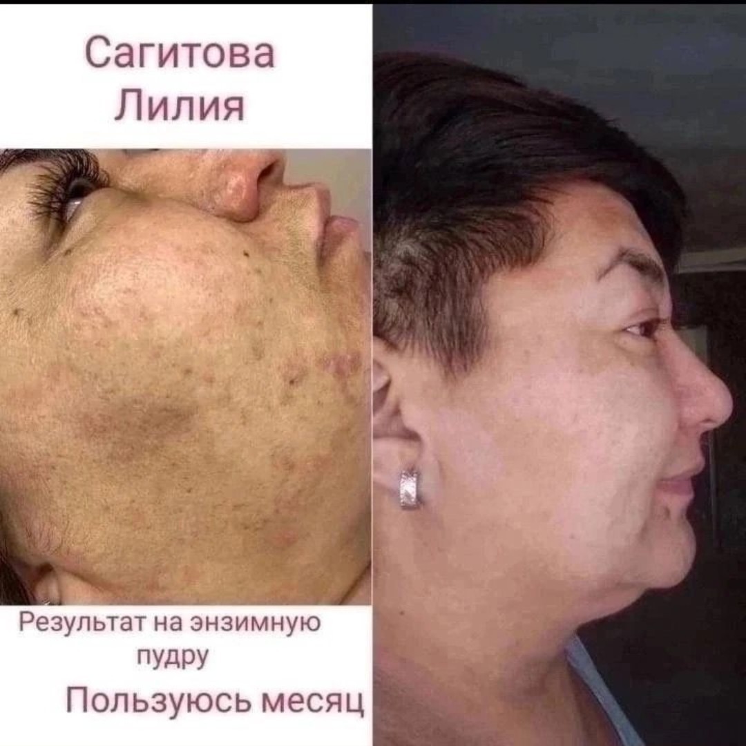 Отзывы на нашу энзимную пудру🥰🥰