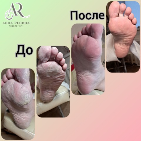 anna_podolog_nail_barnaul в LOOKY. . https://dikidi.net/8...
