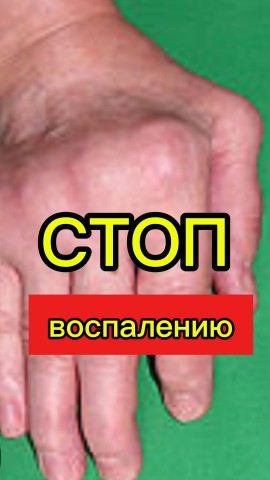Olga_bio_ life в LOOKY. #ревматоидныйартрит,#артрит,#3дматрикс,#ремиссия,#клеточноепитание,#agenyz,#жизньвремиссии,#жизньбезболей,#нутриенты,#скованностьсуставов,#артрит,#гастрит,#гонартроз,#артроз,#коксартроз,#кандида,#биокорректоры,#кандидоз,#остеопороз,#заменасустава. 💥Восстановить суста...