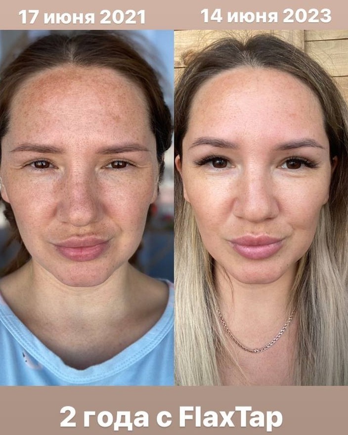 Kosmetik_flaxtap в LOOKY — Уходовые процедуры : FlaxLift, FlaxNewSkin.
Домашний уход  F