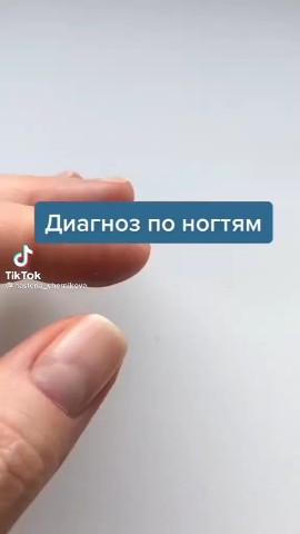 Игорь Борисович в LOOKY. #диагностикаПоногтям. #диагностикаПоногтям
