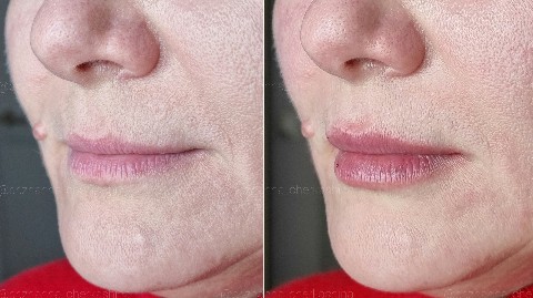 КОСМЕТОЛОГ УВЕЛИЧЕНИЕ ГУБ СПБ в LOOKY. #ПластикаГуб,#BeloteroLipsContour,#ВрачКосметолог,#Жанна_Черкашина,#увеличениегубспб,#контурнаяпластикаспб,#косметологспб,#контурнаяпластикагубспб,#пухлыегубкиспб,#красивыегубыспб,#сделатьгубыспб,#спб,#питер,#хочугубыспб,#увеличениегубпитер,#губыспб,#длт,#длтспб,#увеличениегубмосква,#губымск,#сделатьгубымосква,#spb,#увеличениегубмск,#belotero,#beloterolips,#белотеро,#белотеролипс,#beloterofiller,#beloterocontour,#губы_beloterocontour. ⠀
Контурная #Пластик...
