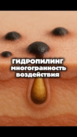 olgavladi_kis в LOOKY. . Все сезонный гидропи...