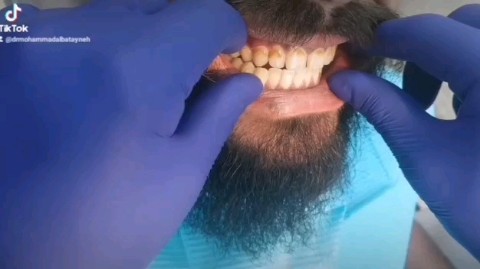 Dr Mohammad Albatayneh в LOOKY. . Teeth cleaning and t...