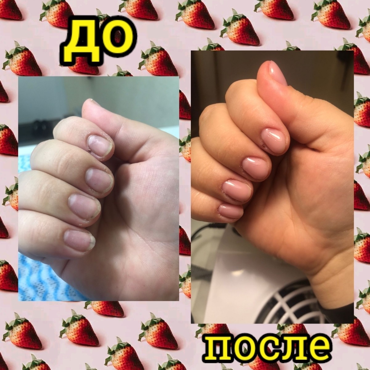 Работа на своих ноготках💅💅💅