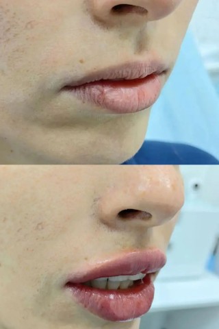 Афина Эстет в LOOKY. . Stylage M.
Почему им...
