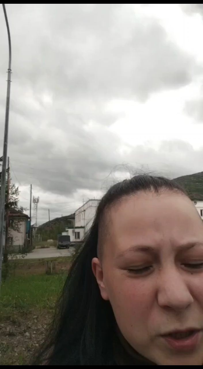 Анна Устинова в LOOKY. . О витилиго и профила...