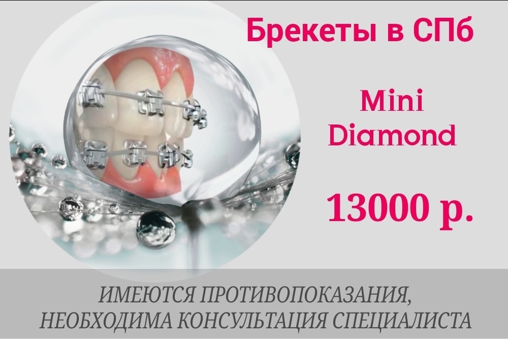 ❗️📢Специальные цены на исправление прикуса и брекеты в СПб. 
📍Специальная цена на лигатурные брекеты Mini Diamond - 13000 р. вместо 26000 р. (на 1 челюсть) 
В стоимость входит: выбранная брекет-система и фиксация.

Записаться на бесплатную консультацию или задать дополнительные вопросы вы можете по тел. 
+7 921 903-19-88 СПб, наб.Канала Грибоедова, 14

Также проводится лечение зубов, чистка зубов, протезирование и имплантация.
[#санктпетербург ](санктпетербург)