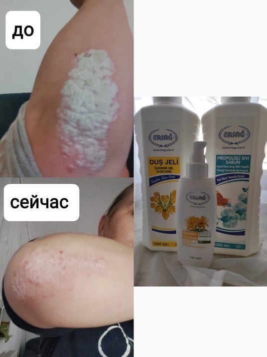 Lesya_Ersag в LOOKY — ОТЗЫВЫ:

☀ От Тани:
гель для душа тюльпан помог человеку пос