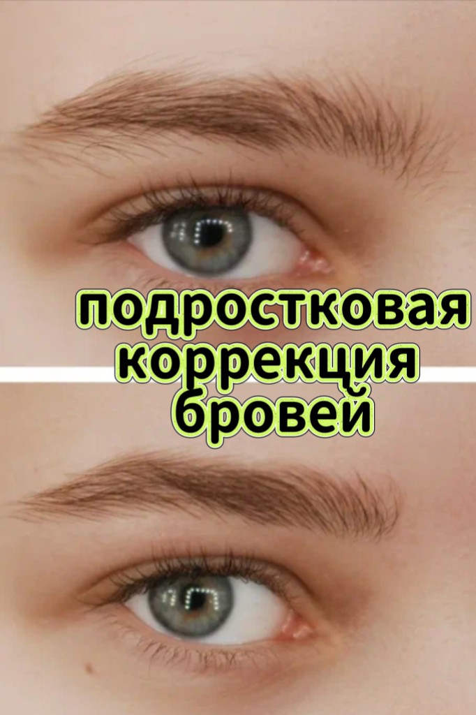 ЯНИЦКАЯ ТАТЬЯНА in LOOKY. . Подростковая коррекц...