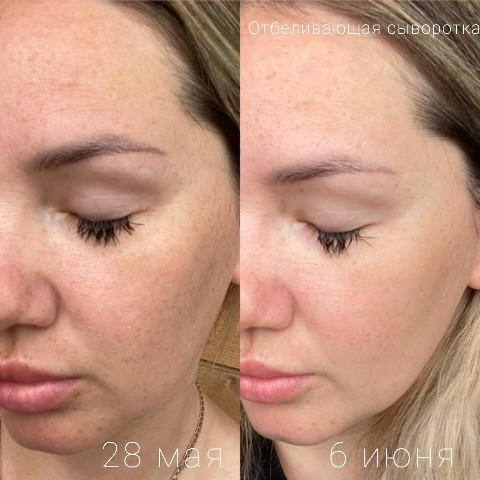 Kosmetik_flaxtap в LOOKY. #сывороткадлялица#отбеливающаясыворотка. Отбеливающая сыворот...
