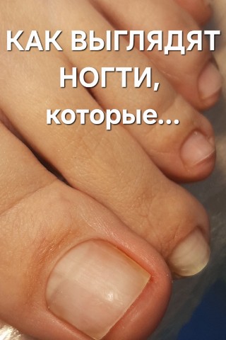 Афонина Екатерина в LOOKY. . Эти ножки 2 года без...