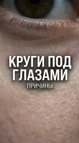 Афина Эстет в LOOKY. #Биоревитализациякраснодар,##углыДжоли,#ViscolaineVolumeфиллеры,#губымечты,#скулы,#лифтингкраснодар,#красотабезвозраста#преображение,#клиникаэстетики#АфинаЭстетстилажм,#beloterosoftкрд,#контурнаяпластика,#носослезнаяборозда,#губыстилаж#свежийвзглядкраснодар#красотабезвозраста. Периорбитальная зона...