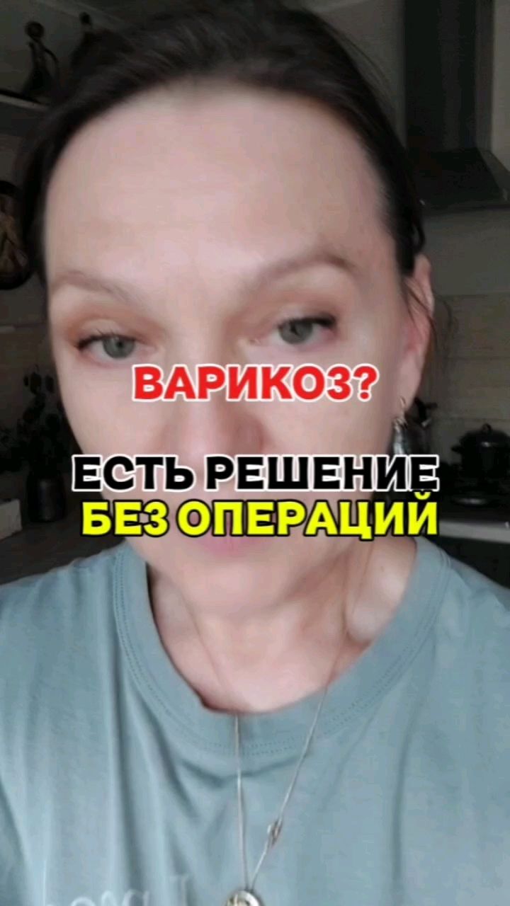 ОБУЧАЮ ЖЕНЩИН ДОХОДУ И ЗДОРОВЬЮ в LOOKY. #варикозначинающийся,#гемморой,#венынаногах. Варикоз... Ноги гудя...