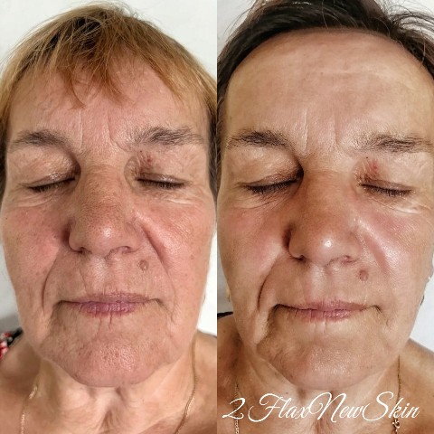 Kosmetik_flaxtap в LOOKY. #FlaxNewSkin#kostroma. ⛔Летом нельзя делать...