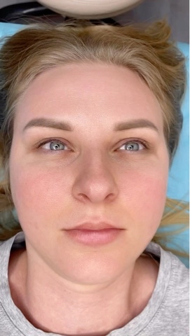 Halal_Beauty в LOOKY. #краснодар,#ресницы,#ламинированиересниц,#стрейчингресниц,#ламимейкер,#яблоновский,#севастополь. WAY😍😍👇
СТРЕЙЧИНГ ...