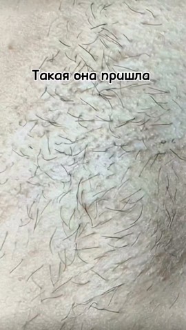 beauty_mix64 в LOOKY. #электроэпиляциясаратов,#красотасаратов,#уходзасобойсаратов,#гладкаякожасаратов,#косметологиясаратов. ТРАНСФОРМАЦИЯ

Что в...