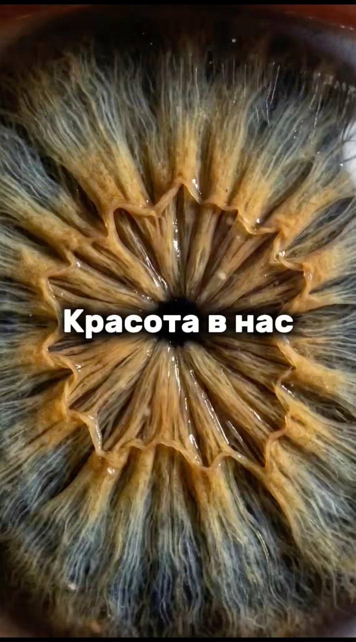 Вероника Квашнина в LOOKY. #радужкаглаза. Радужка глаза и косм...
