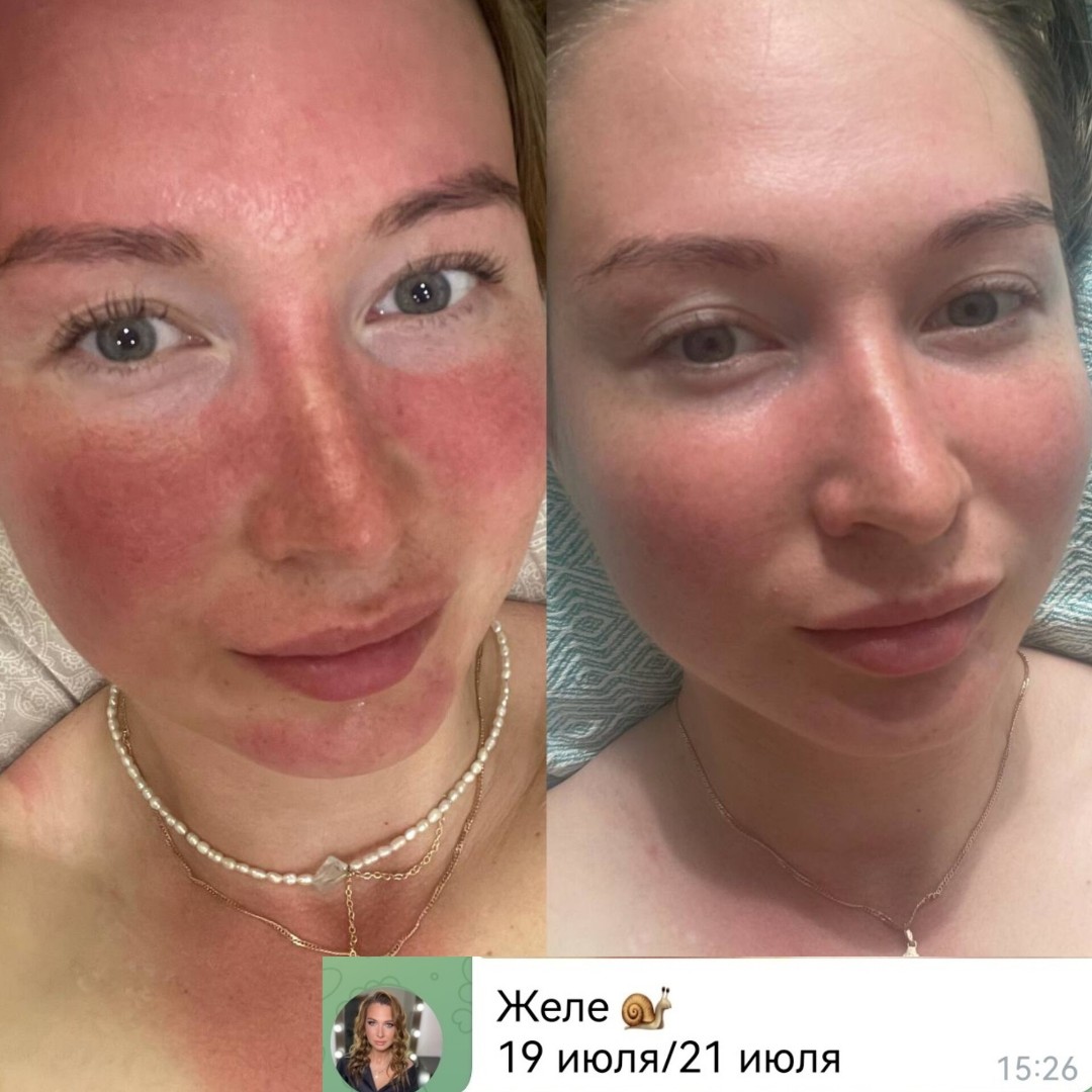 Kosmetik_flaxtap