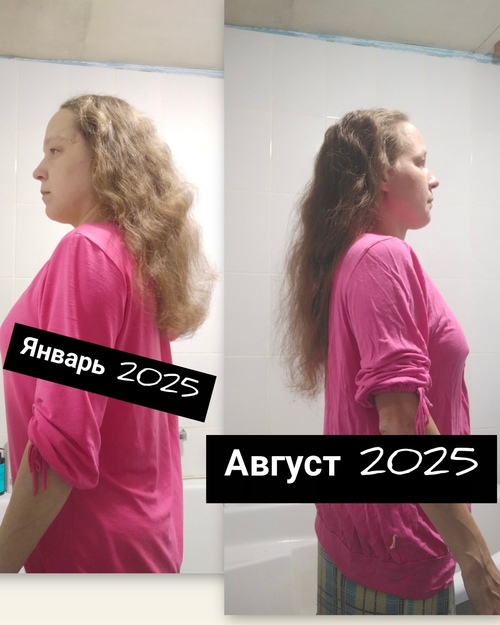 Как я спасла свои волосы после родов" 💇‍♀️✨

После рождения малыша я заметила, что волосы начали выпадать… и не просто выпадать, а уходить пучками! 😱
Каждое мытьё или расчёсывание превращалось в маленькую трагедию. Я смотрела в зеркало и думала:
"Всё… моя шевелюра обречена" 😔

Но я решила бороться. Начала с базы:
✔ Коллаген
✔ Омега-3
✔ Витамин D3

Плюс подключила шампунь и бальзам с гуминовыми кислотами.

Через курс приёма — и о чудо! — волос на расчёске стало в разы меньше.
Недавно вышла новинка Коллагентринити, и я сразу добавила его в свой рацион. А уход сменила на Occuba (восстанавливающий шампунь и кондиционер).

💫 Эффект почувствовала уже после первого применения: волосы мягкие, блестящие, послушные… и главное — я больше не боюсь расчёски!

👑 Девочки, волосы — это наша корона. Берегите их!

💌 Хотите, соберу для вас мой комплекс для красоты и силы волос и помогу оформить со скидкой до 10%?
Напишите в комментариях или в личку: "Хочу волосы мечты" 💬