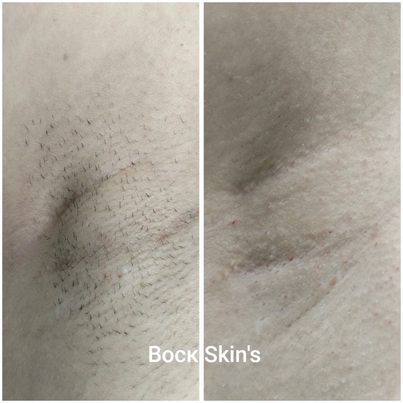 epiliti__moscow в LOOKY — ✨ Почему Skin`s — это классно

· Качество: Убирает волосы от