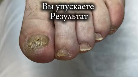 podolog34.ru в LOOKY. #волгоградскийцентрподологии. Не стесняйтесь обращ...