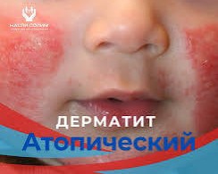 Леся в LOOKY. . ОТЗЫВ С ЧАТА: Мы муч...