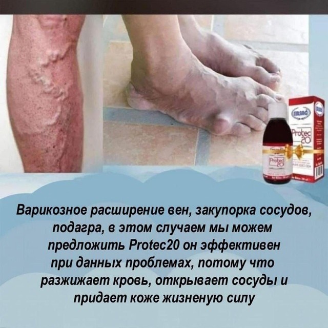 Леся в LOOKY — ❓Для чего нужен PROTEC20❓
⃣ -Те, кто страдает респираторнои‌