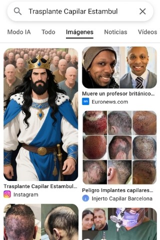 HairTransplant в LOOKY. #hairtransplant,#trasplantecapilar,#trapiantocapelli. #hairtransplant
#tra...
