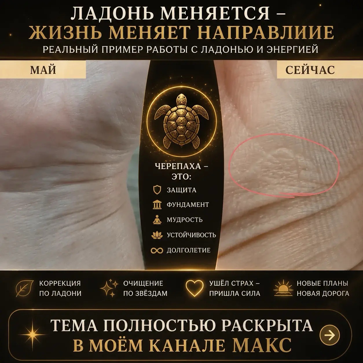 🐢 ЭТОТ ЗНАК ПОЯВИЛСЯ НА ЛАДОНИ ПОСЛЕ НАШЕЙ РАБОТЫ…

И когда я его увидела, сама несколько раз увеличила фотографию.

Женщина пришла ко мне ещё в мае. На линии Жизни были моменты, которые меня заинтересовали, а сама она находилась в состоянии сильного страха и чувствовала, что в её жизни что-то не так.

Мы начали работать с ладонью: я дала ей коррекцию, параллельно проводила свою практику очищения.

Прошло время.

И на новом фото я увидела на первом браслете запястья необычную фигуру — ЧЕРЕПАХУ. 🐢

Для меня этот символ связан с устойчивостью, защитой, мудростью и долголетием.

Но самое интересное даже не это.

Посмотрите на черепаху: на суше она медленная, а стоит ей попасть в СВОЮ ВОДУ — она становится совершенно другой.

Именно поэтому этот знак я прочитала для неё ещё и как послание:

«НАЙДИ СВОЮ ВОДУ. НАЙДИ СВОЁ МЕСТО».

Что изменилось на ладони за это время, почему я обратила внимание именно на этот знак и что происходило с самой женщиной после нашей работы — полностью рассказала и показала в своём канале в MAX. ❤️

Здесь оставляю только часть этой истории.

А продолжение, фотографии ладони ДО/ПОСЛЕ и полный разбор уже ждут вас в MAX.

Ссылка 👉 https://max.ru/join/7q6NvYMPQNnJpBNMX1wTkJ_iFNwkeRyCbxN2oWSncoc

Переходите и посмотрите сами. Особенно если вы никогда раньше не сравнивали, как меняются линии и знаки на ваших ладонях. ✋