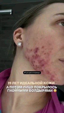 ZoyaBesedina в LOOKY — Результат налицо и на лице!!!
Очевидное неаероятное!
[#фитла